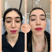 کلینیک زیبایی رز سفید 30 % off تابستانه
