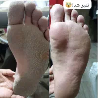 خدمات دست و پا