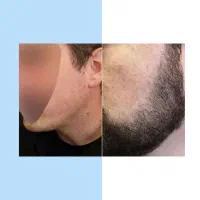 جذابیت ریشه دار