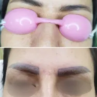 مرکز تخصصی ریمو ابرو، کک مک و خال