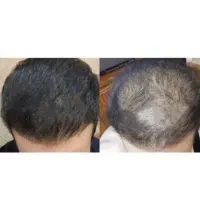 حتی از کاشتم بهتره..