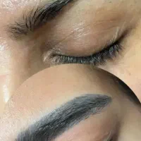لیزر تتوی ابرو با دستگاه لیزر کیوسوئیچ