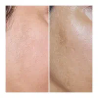 کرم  ضد لک و روشن کننده بیوممتیک