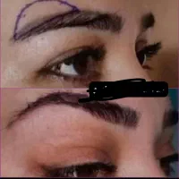 آف جراحی بینی ۲۰ت دراهوازلیپوساکشن ولیفت