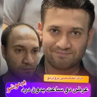 پروتز هالیوودی مراکشی