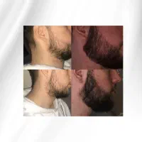 ریش هخامنش