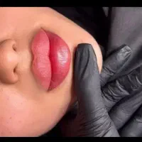 تزریق ژل و فیلر و بوتاکس و مزوژل با کمترین قیمت