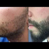 رازوراه ودرمانت پیش منه