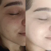 فیشال ۱۷مرحله‌ای رویایی شما، فقط با دویست و پنجاه