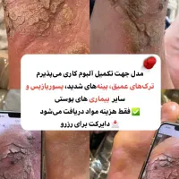 مدل برای پدیکور