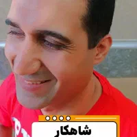 کاشت مو شیرازی