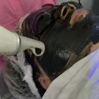 درخشش طبیعی پوست شما، با فیشیال تخصصی ما