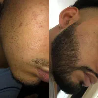 تیغ زدن ممنوع شد