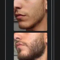 معجزه ریش و سبیل