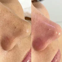 فیشال تخصصی پوست- فراتر از یک پاکسازی ساده