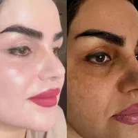 کرم vip برای درمان مشکلات پوستی