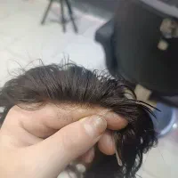 تعمیرپروتز مو،ترمیم پروتز مو