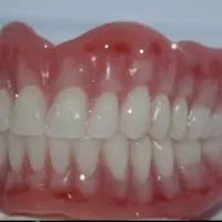 پروتز دندانی(مصنوعی‌)
