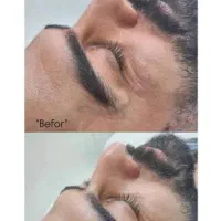 پاکسازی پوست و فیشیال صورت اقایان