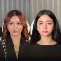 پکیج جوانسازی /کانتور /رفع لاغری صورت/فیلر