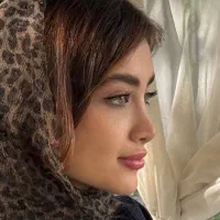 جراحی بینی برای مراجعین لردگان/انجام عمل درتهران