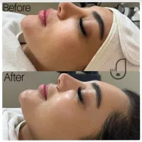 فیشیال پوست خانم‌ها و آقایان در شیراز، فرهنگ شهر