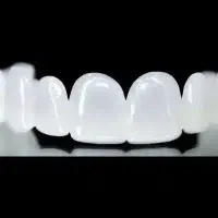 دندانسازی( لبخند نهال ) متحرک و ثابت