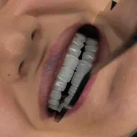 جشنواره ویژه ی دندانپزشکی خرداد ماه