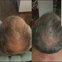 این اقدام اخریشه