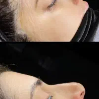 جراحی پلاستیک صورت در شاهرود
