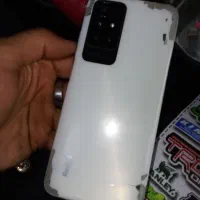 redmi note11شیائومی