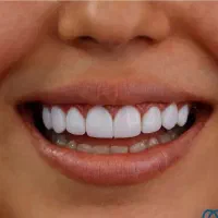 دستیار کنار دندانپزشک