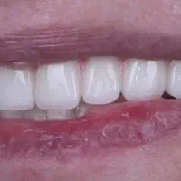 جشنواره کامپوزیت با قیمت مناسب فقط به مدت 3 را روز