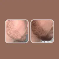 25روزه|آرایشی، بهداشتی، درمانی|اصفهان, عباس‌آباد|دیوار