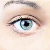 عمل چشم لازک با تعرفه ۱۴۰۴فقط این پنجشنبه