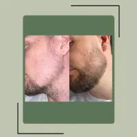 روی.ش م.جدد م.و ری.ش