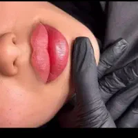 آموزش بوتاکس و فیلر با مدرک معتبر