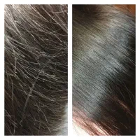 اف پکیج درمانی مو/موخوره گیری ۳۹۰