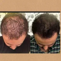 تنها فقط تو ۳۵ روز