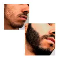 معجزه ریش|آرایشی، بهداشتی، درمانی|باشت, |دیوار