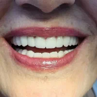 خانم منشی دستیار با تجربه مطب دندانپزشکی ایمپلنت