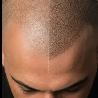 اسکلاپ سر تخصصی