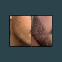 هنوز ریش نداری .اشکال نداره من اینجام