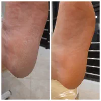 پاکسازی صورت