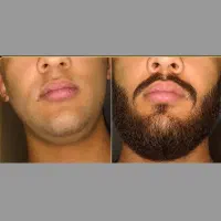 ریش 30 سالگی تو 16 سالگی داشته باش