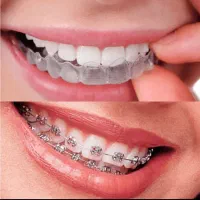 ارتودنسی تخصصی