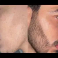 رویش و پرپشتی
