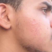گیلانی های عزیز دیگه کاشت ریش ممنوع