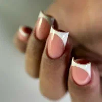 کاشت تخصصی فقط ۳۰۰ برای فردا