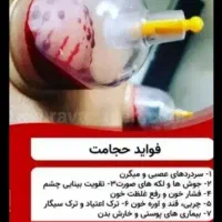(لادیز)حجامت و زالو‌درمانی،طب سوزنی چینی